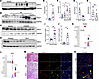SNCA accumulation is a hallmark of kidney diseases marked by leukocyte expa
