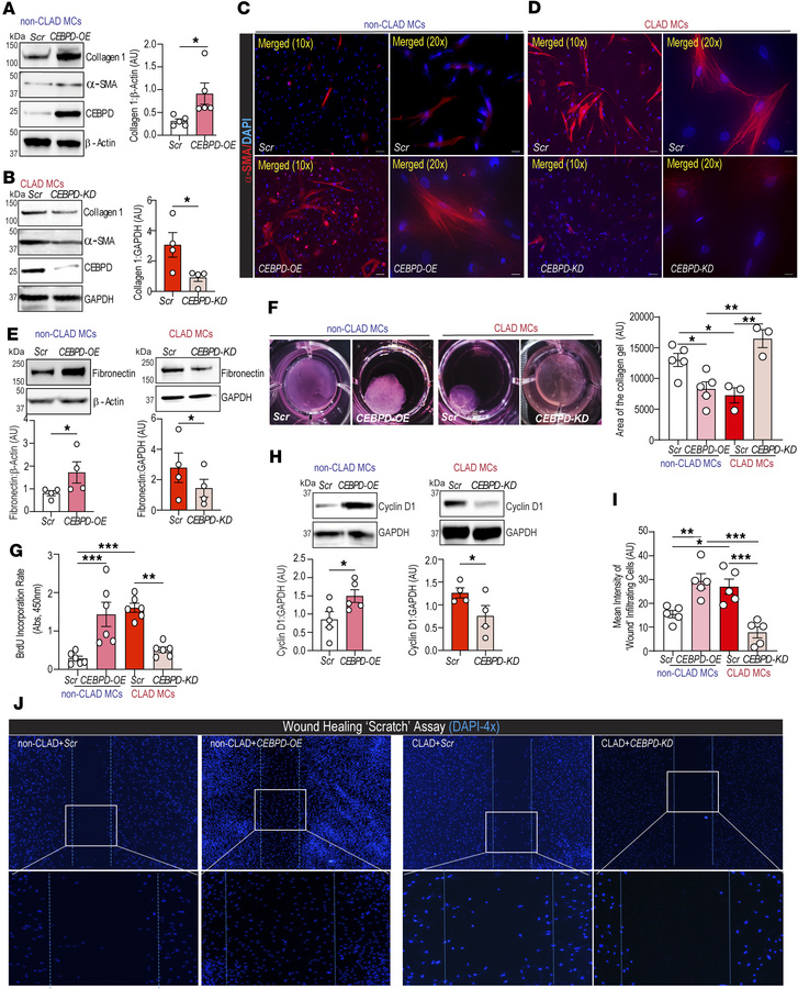 CLAD MC–associated CEBPD promotes fibrogenic functional competence, incl...