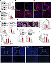 CLAD MC–associated CEBPD promotes fibrogenic functional competence, includi