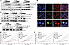 VIC-1911 induces mitotic defects, DNA damage, and apoptosis in PCa cells.