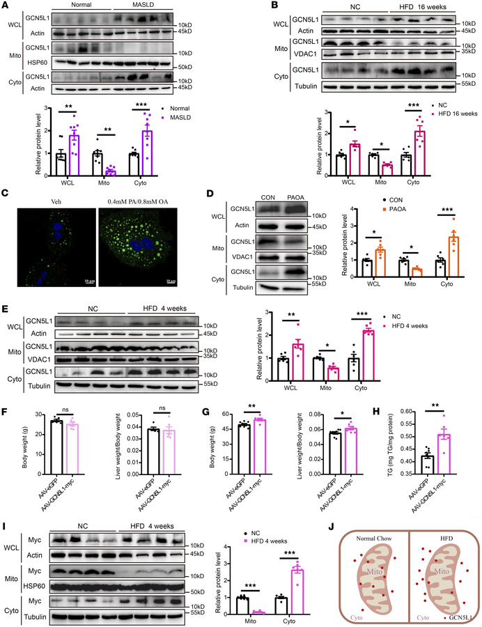 GCN5L1 accumulates in cytoplasm during development of MASLD in both HFD-...