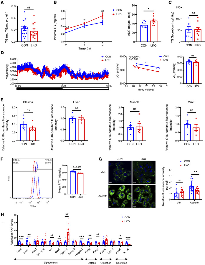 GCN5L1 deletion may inhibit de novo lipogenesis to reduce liver TG in re...