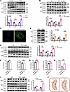 GCN5L1 accumulates in cytoplasm during development of MASLD in both HFD-fed
