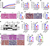 GCN5L1 deletion protects mice from HFD-induced liver steatosis but not live