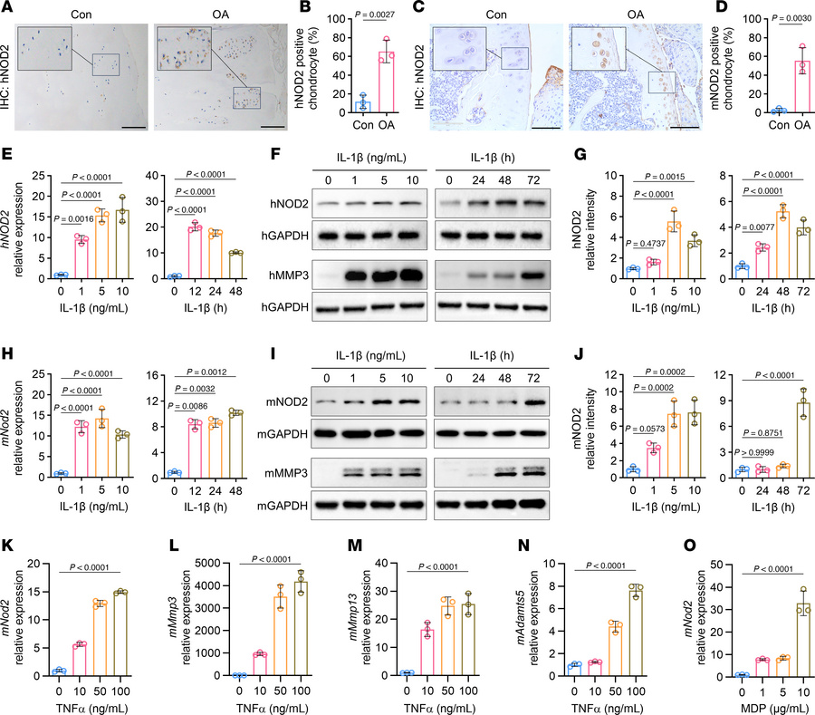NOD2 is activated in both human and mouse osteoarthritic cartilage.
(A) ...