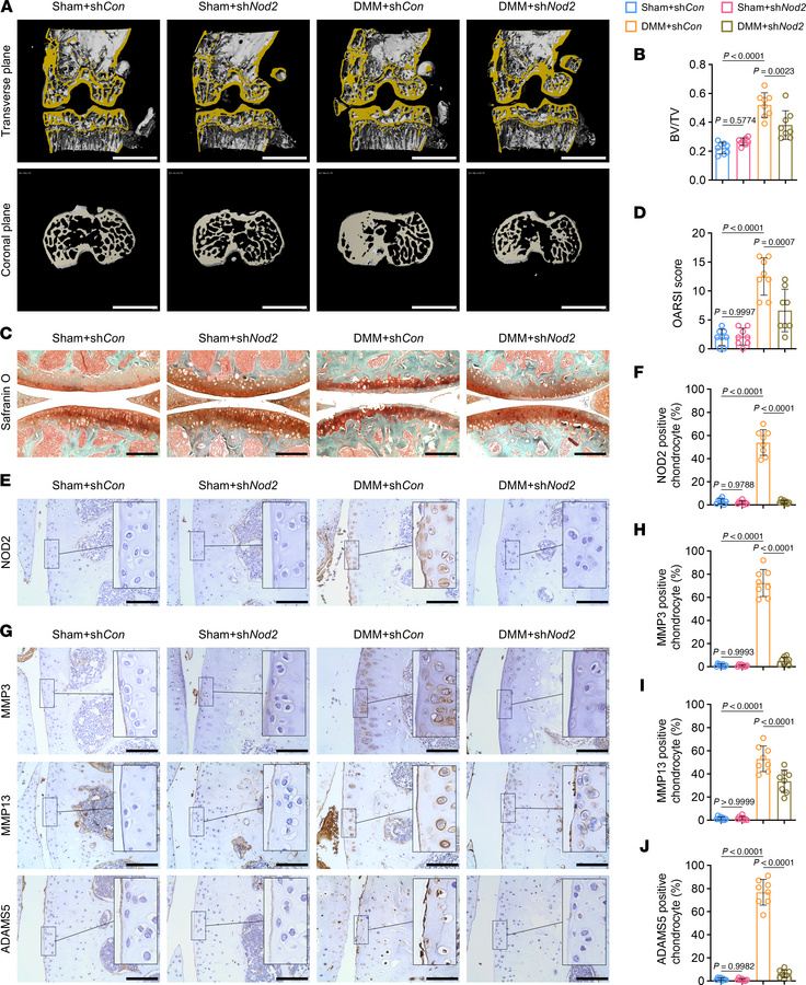 Adenovirus-mediated Nod2 knockdown attenuates cartilage degradation in m...