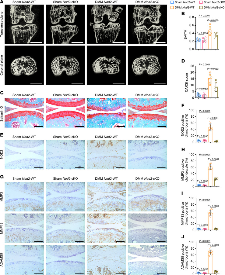 Conditional KO of Nod2 in chondrocytes prevents OA development.
(A) Reco...