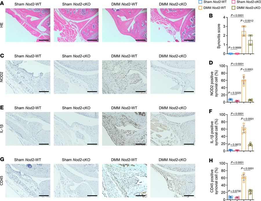 Conditional KO of Nod2 in chondrocytes attenuates synovial inflammation....