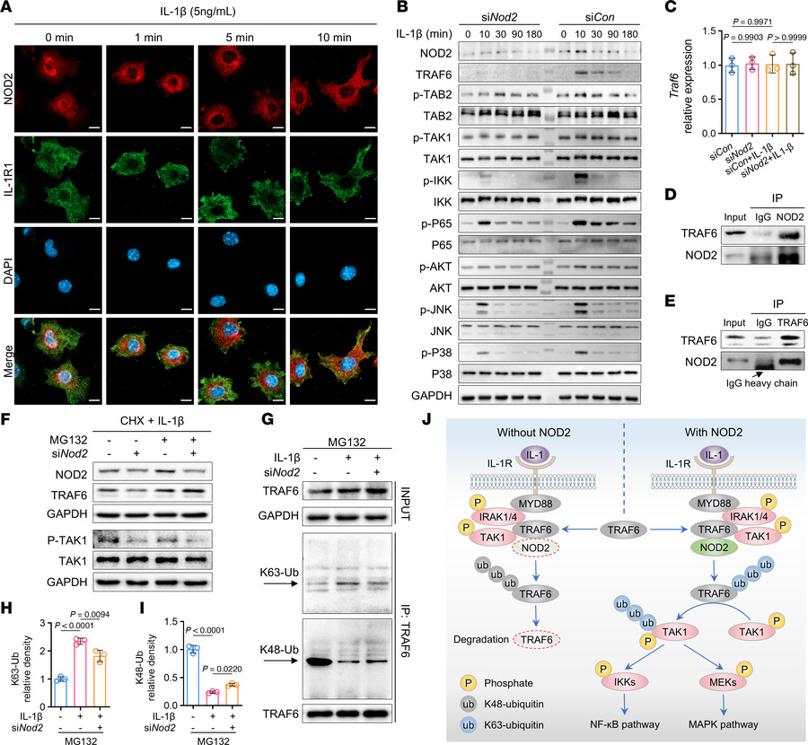 NOD2 amplifies inflammatory signals by regulating TRAF6 stability and ub...