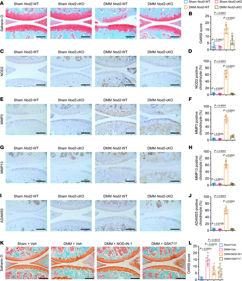 Post-DMM interventions targeting NOD2 attenuate OA development.
(A) Safr...