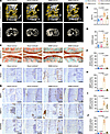 Adenovirus-mediated Nod2 knockdown attenuates cartilage degradation in mous