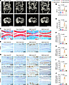 Conditional KO of Nod2 in chondrocytes prevents OA development.