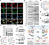 NOD2 amplifies inflammatory signals by regulating TRAF6 stability and ubiqu
