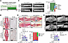 Ablation of proliferating Osterix-expressing cells during fracture healing