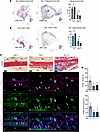 Sp7/Osterix-expressing callus cells proliferate during fracture healing.