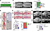 Ablation of proliferating osteocalcin-lineage cells during fracture healing