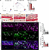 Bglap/osteocalcin-expressing callus cells proliferate during fracture heali