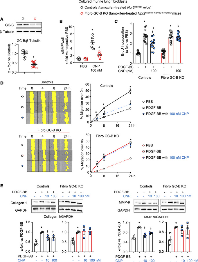 Comparison of GC-B expression and signaling in lung fibroblasts isolated...