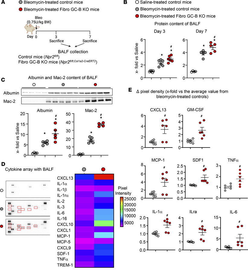 Fibroblast-restricted GC-B deletion exacerbates bleomycin-induced lung i...