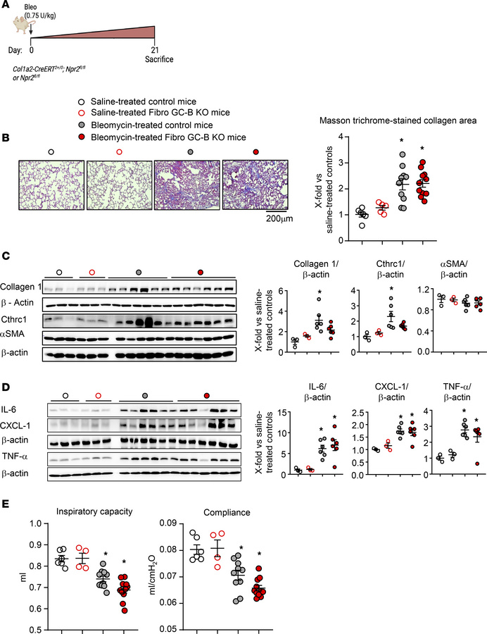 Fibroblast-restricted GC-B deletion does not significantly alter bleomyc...