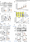 CNP, via GC-B/cGMP signaling, attenuates the profibrotic and proinflammator
