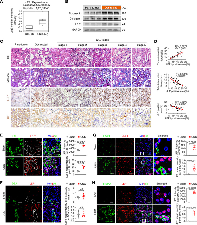 JLP expression is inversely correlated with LEF1 level in fibrotic kidne...