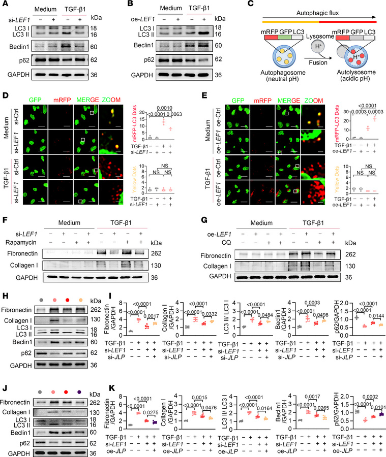 LEF1 regulates autophagy activity via JLP in TECs.
(A and B) Western blo...