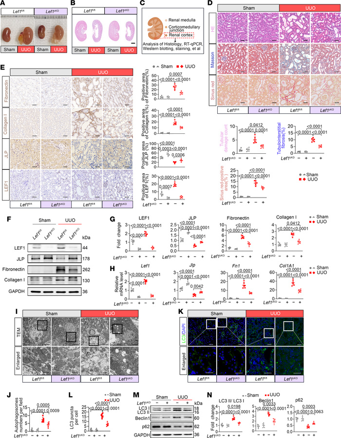 Renal tubule–specific Lef1 deficiency ameliorates renal fibrosis.
(A) Gr...