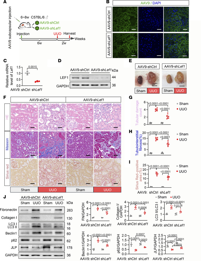 AAV9-mediated knockdown of renal Lef1 mitigated kidney fibrosis.
(A) Sch...