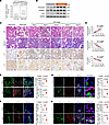 JLP expression is inversely correlated with LEF1 level in fibrotic kidneys