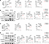 LEF1 exerts profibrotic effects on TECs under TGF-β1 stimulation.
