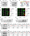 LEF1 regulates autophagy activity via JLP in TECs.