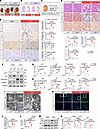 Renal tubule–specific Lef1 deficiency ameliorates renal fibrosis.