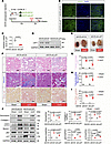 AAV9-mediated knockdown of renal Lef1 mitigated kidney fibrosis.