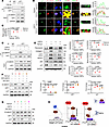 Pharmacological inhibition of LEF1 reduces TEC injury and attenuates TGF-β1