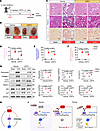 Pharmacological inhibition of LEF1 reduces TEC injury and attenuates UUO-in