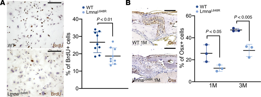 Expansion of osteoprogenitors affected by progeroid accumulation of prel...