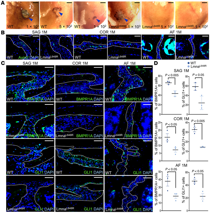 Suture stem cell deficiency in LmnaL648R mouse model for human progeroid...