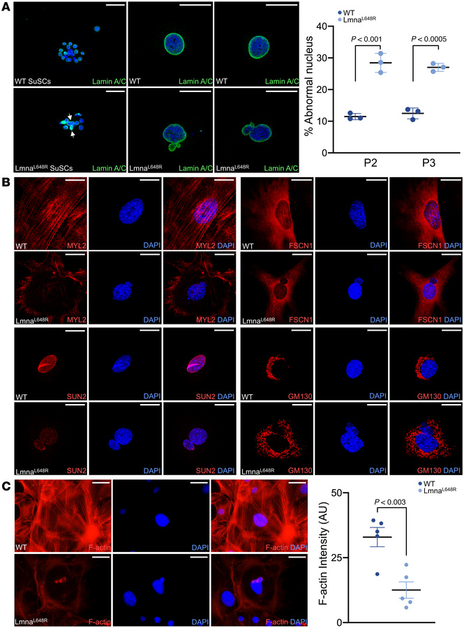 Cytoskeletal disruption by the progeroid accumulation of prelamin A.
(A)...