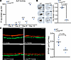 Progeroid accumulation of prelamin A impairs osteogenesis.
