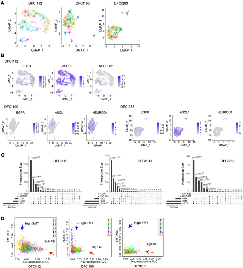 Intratumoral heterogeneity in pleural effusions of patients with EGFR-mt...