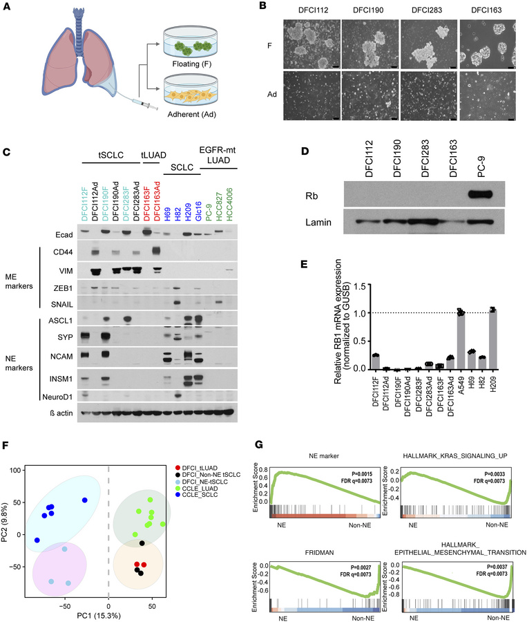 The cell lines established from SCLC-transformed patients demonstrate ph...