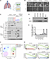 The cell lines established from SCLC-transformed patients demonstrate pheno