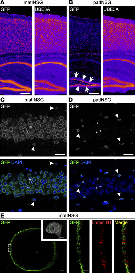 Validation of Sun1-sfGFP as an allele-specific, nuclear envelope–localiz...