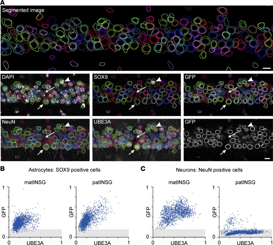 Relationship between UBE3A and Sun1-sfGFP labeling in individual cells i...