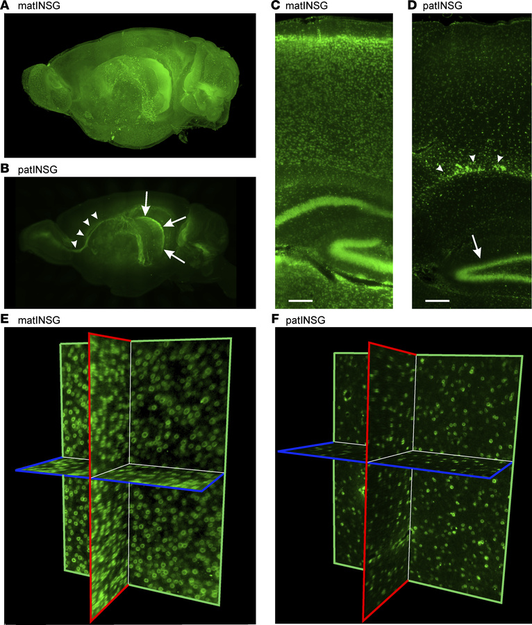 Brain-wide imaging of the Sun1-sfGFP reporter using LSFM.
(A and B) Maxi...