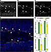 Sun1-sfGFP is expressed in immature neurons in the patINSG hippocampus.