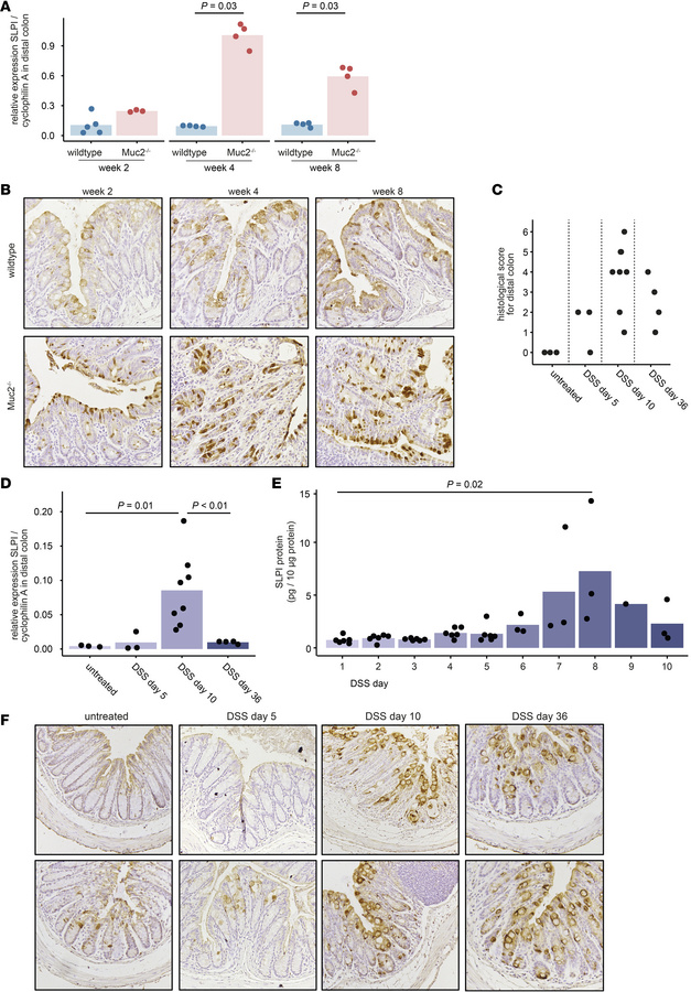 SLPI expression is upregulated in the distal colon of Muc2–/– mice, and ...