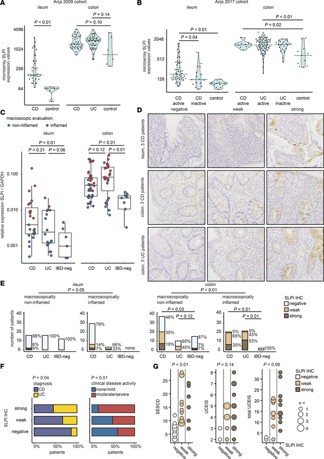 SLPI expression is increased in colonic epithelium of therapy-naive pedi...