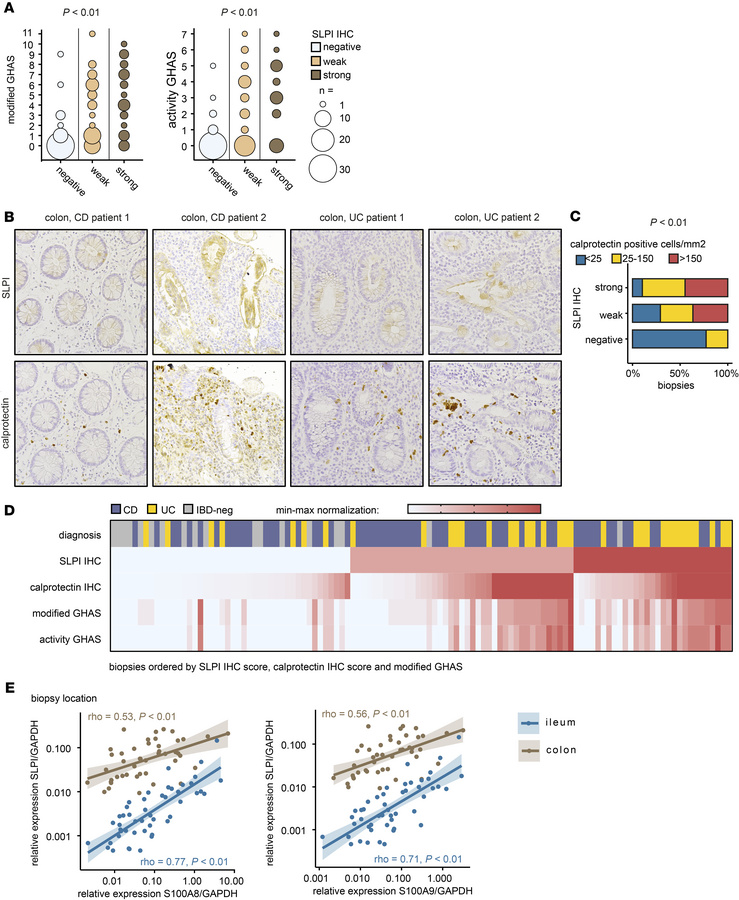 Colonic epithelial SLPI expression is associated with histological disea...